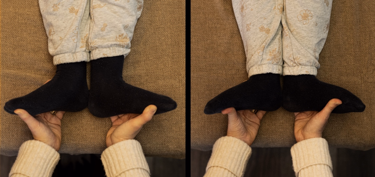 Вирівнювання довжини ніг та стабілізація опор