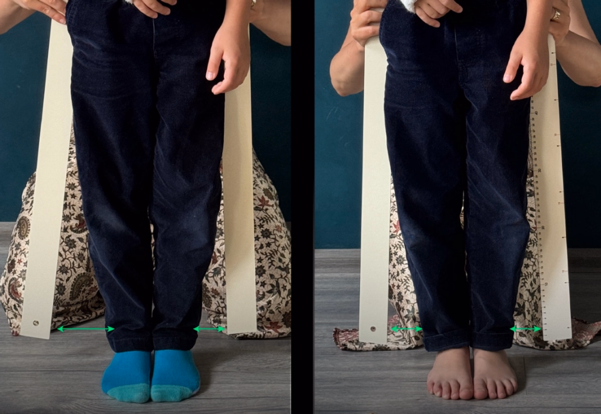 Симетрія тазу та вирівнювання довжини ніг