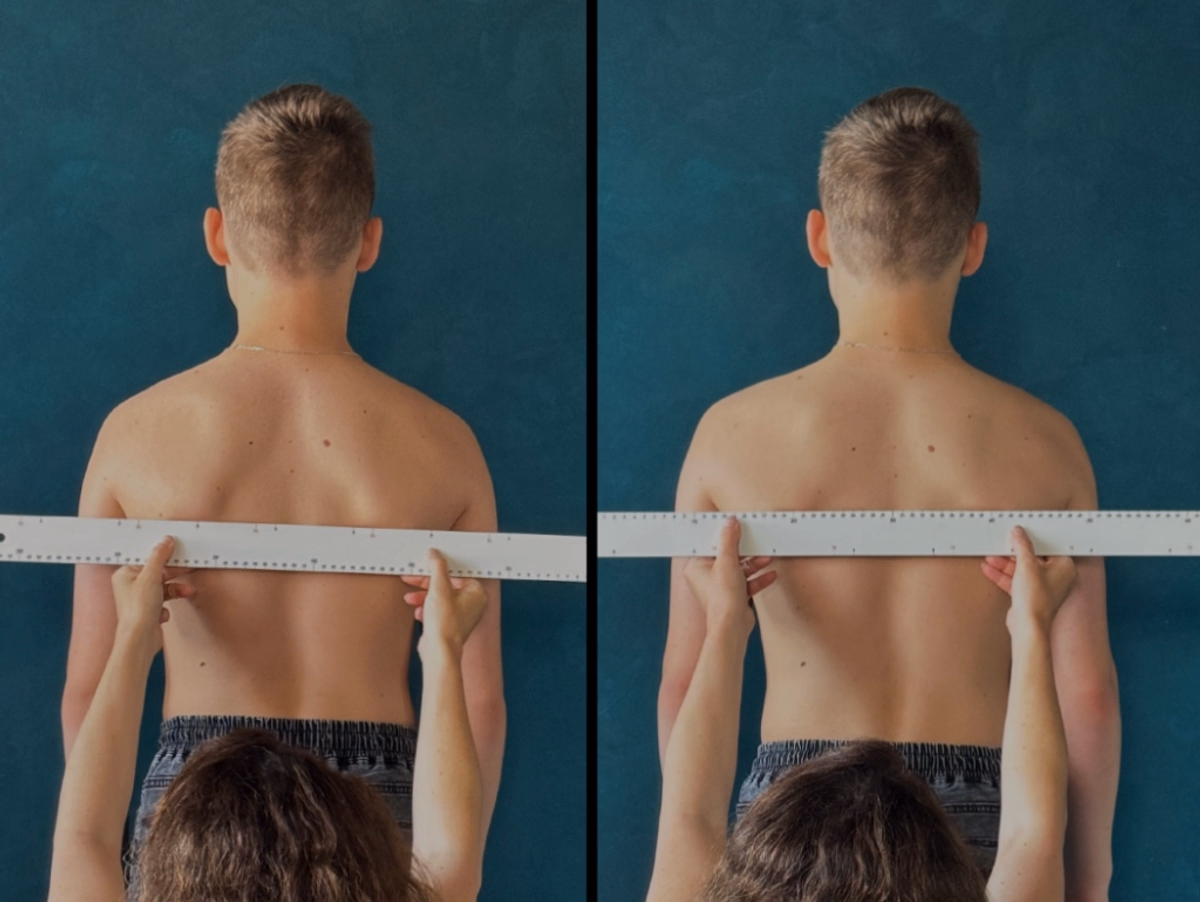 Відновлення симетрії плечей та зняття напруги, що утворювала сутулість