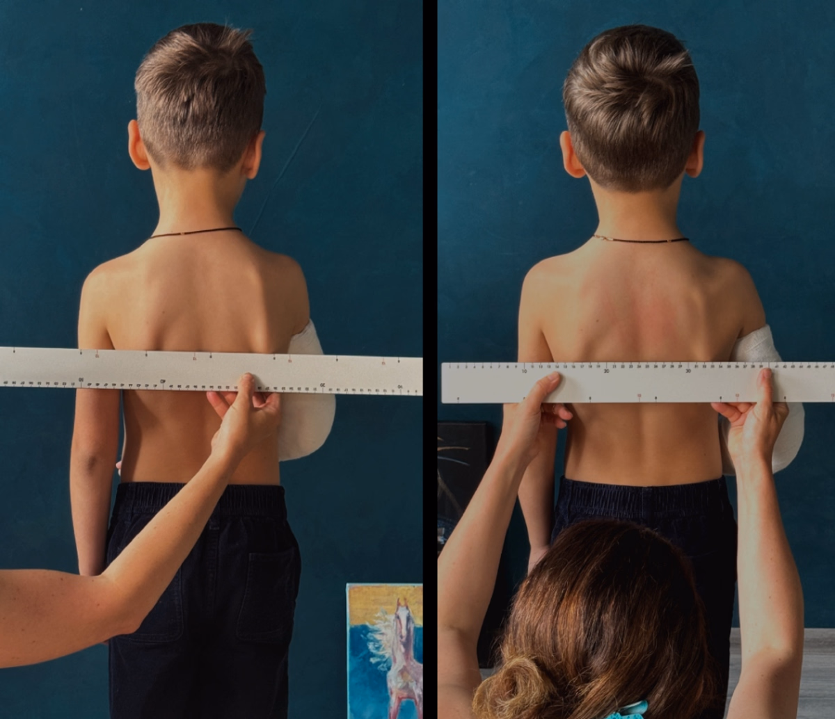 Вирівнювання лінії плечей та лопаток